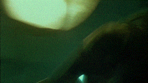 I woke up. All I could taste was blood.